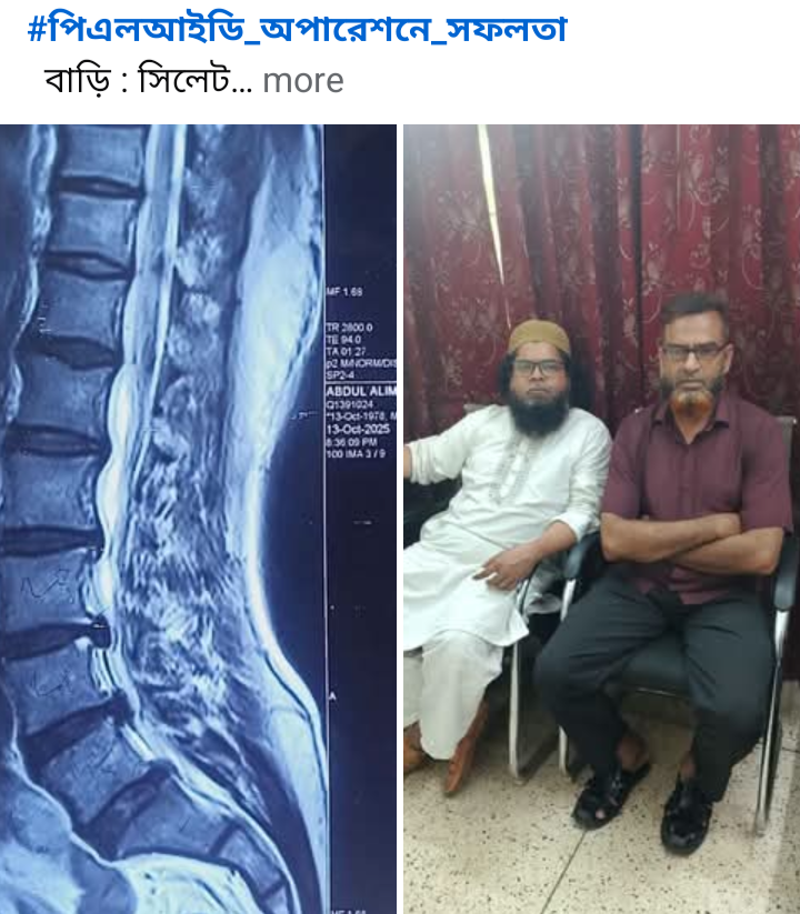 পিএলআইডি অপারেশনে সফলতা।  ফ্যাসেট স্ক্রু।
