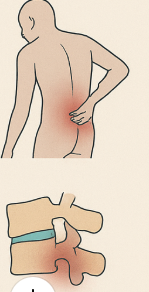 পিএলআইডিতে এই ৮টি উপসর্গের যেকোন টা থাকলে অপারেশন লাগবেই।