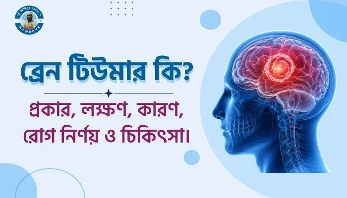 ব্রেন টিউমার কি? - প্রকার, লক্ষণ, কারণ, রোগ নির্ণয় ও চিকিৎসা।